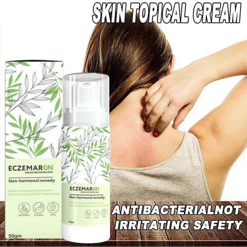 Ecze+ Anti Fungal Spray (Buy 1 Get 1 Free🔥🔥)